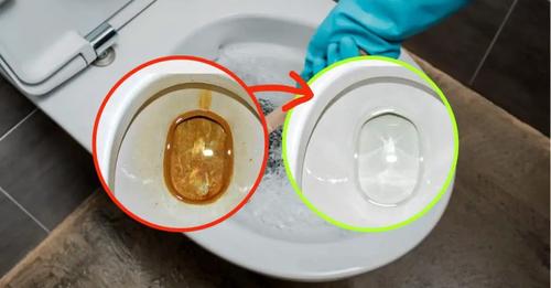 How to remove dirt and yellow stains from the toilet, the new foolproof method