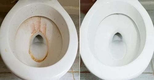 Toilet full of rust and lime, forget about bleach: you can solve the problem in the kitchen