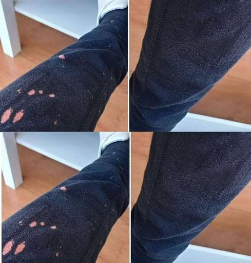 How to easily remove a bleach stain from clothing