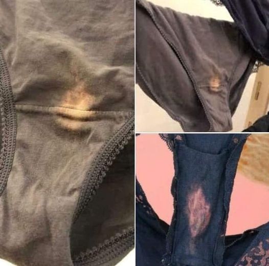 If you find a “bleach” patch in your underwear, you had better know what it means