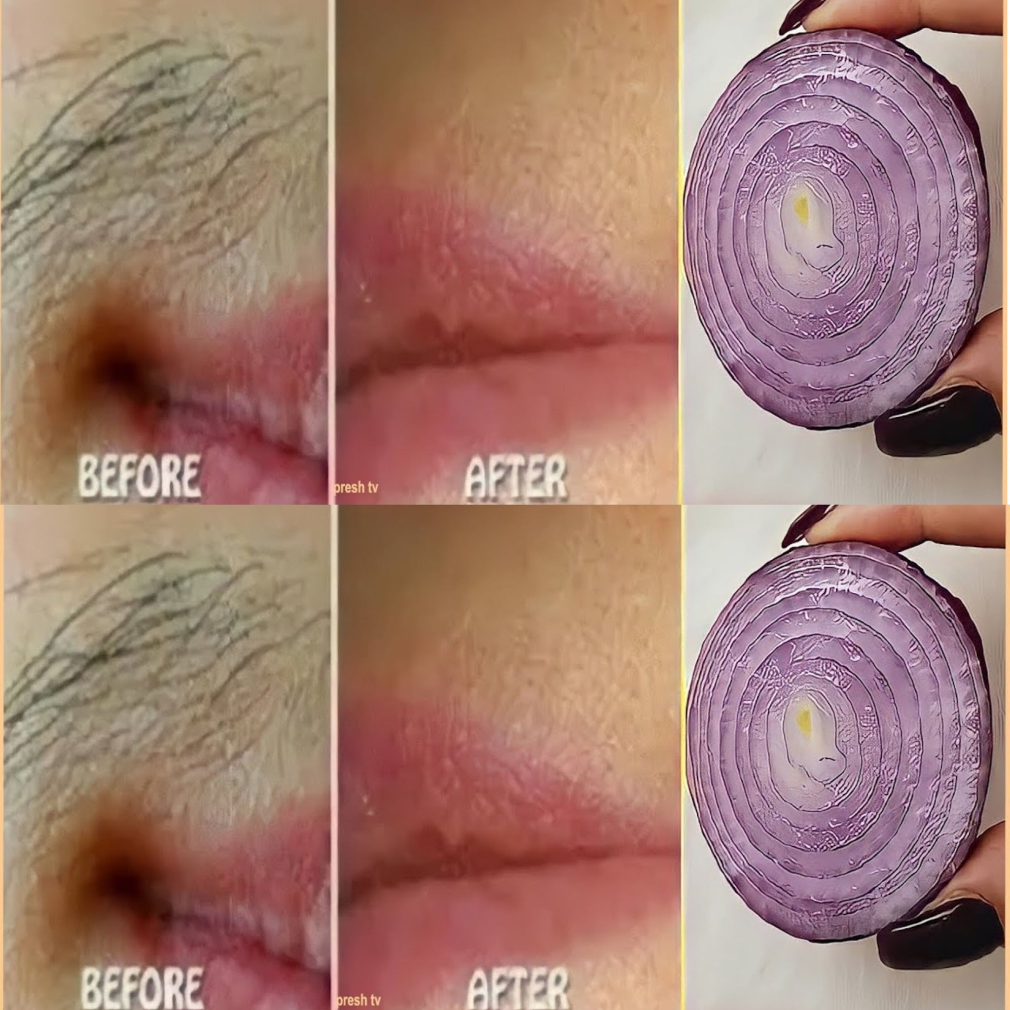 Remove Unwanted Facial Hair Permanently with Onion: Quick and Natural Remedy