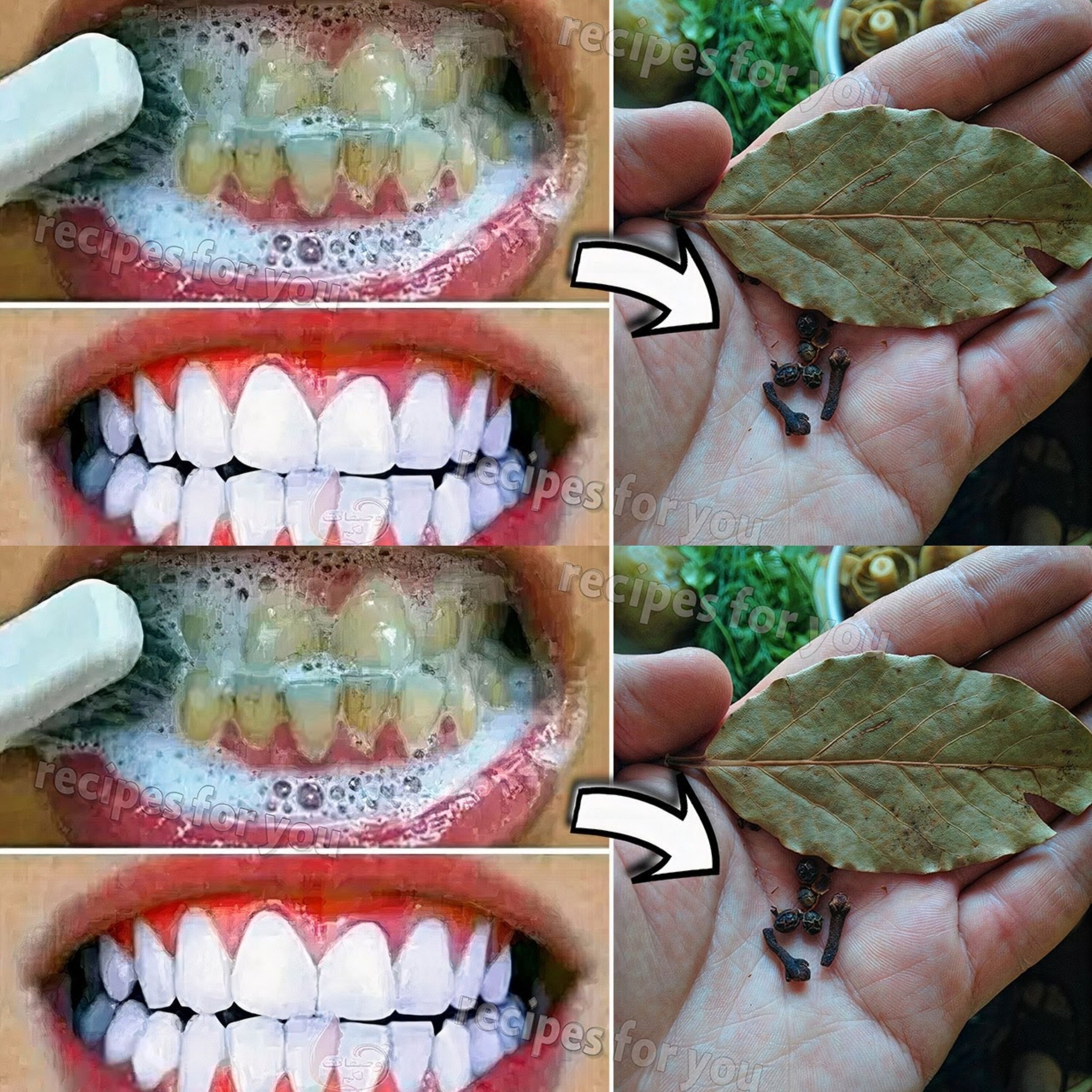 The Secret Dentists Don’t Want You to Know: Remove Tartar and Whiten Teeth in Just 2 Minutes Using Cloves and Bay Leaves