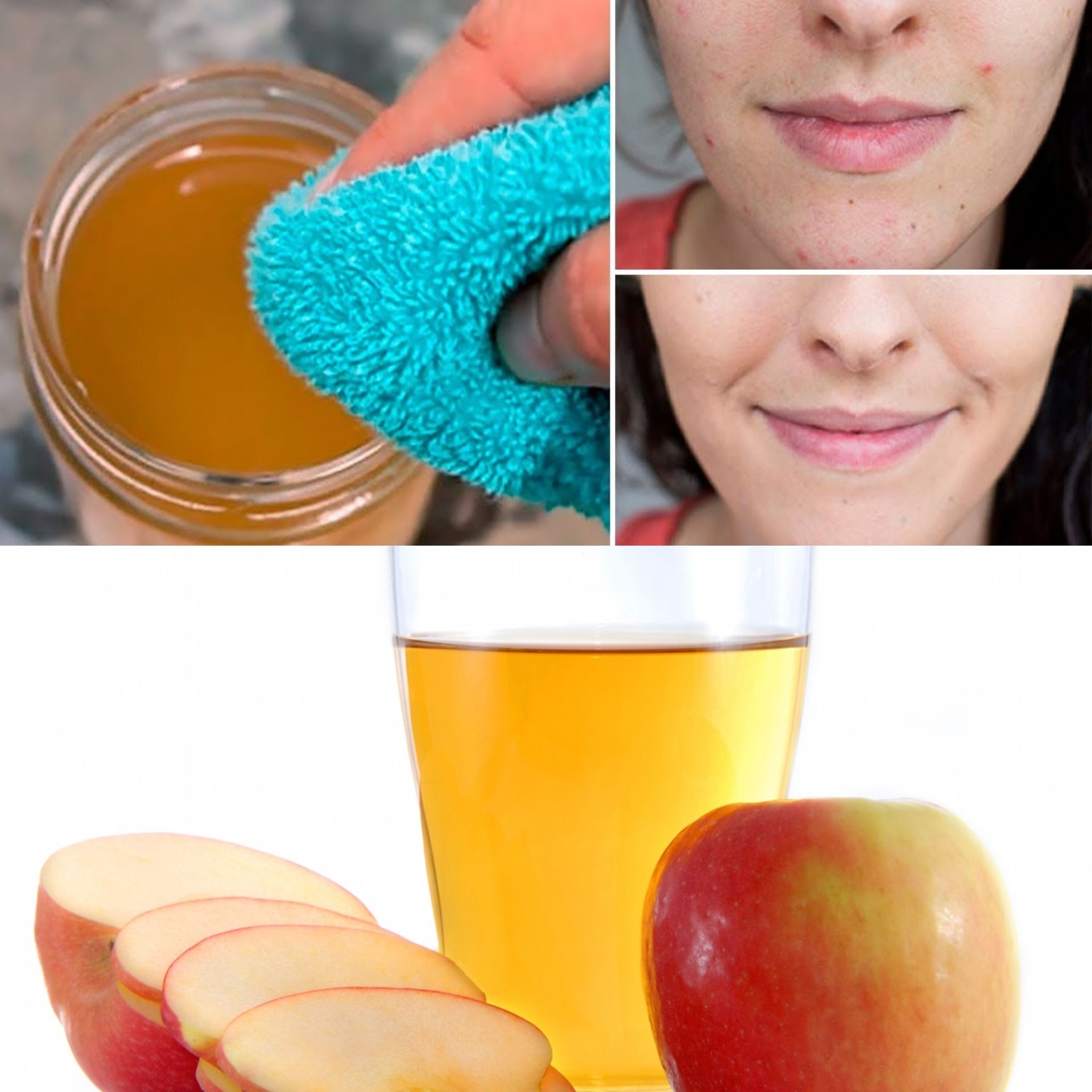 Why You Should Wash Your Face with Apple Cider Vinegar