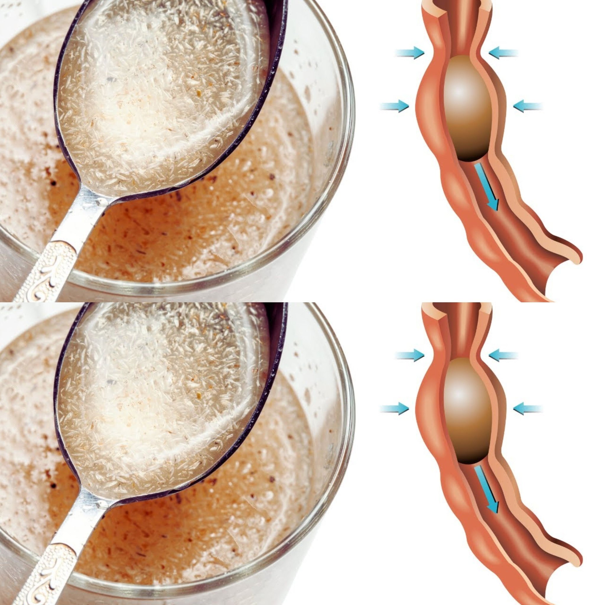 The Remarkable Effects of Fiber on Blood Sugar Control