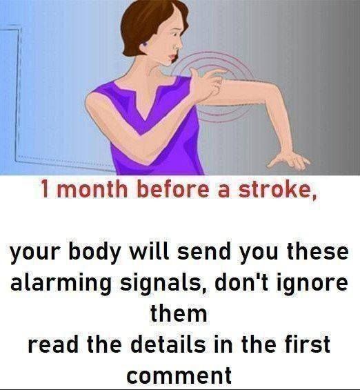 Stroke: These warning signs that appear 1 month before 