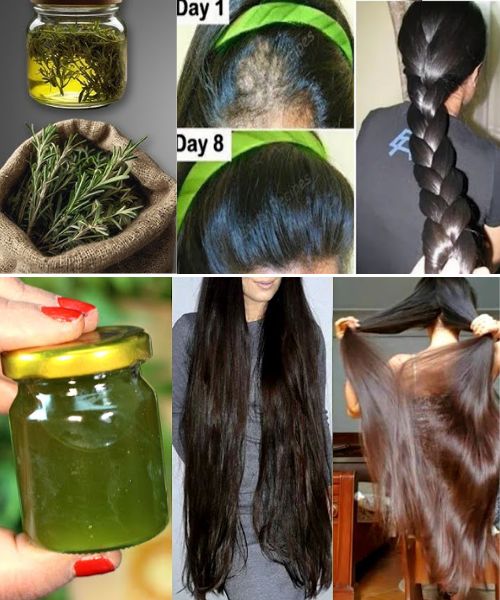 Hair in This Family Grows Like Crazy! Rosemary Black Oil Triggers Insane Hair Growth