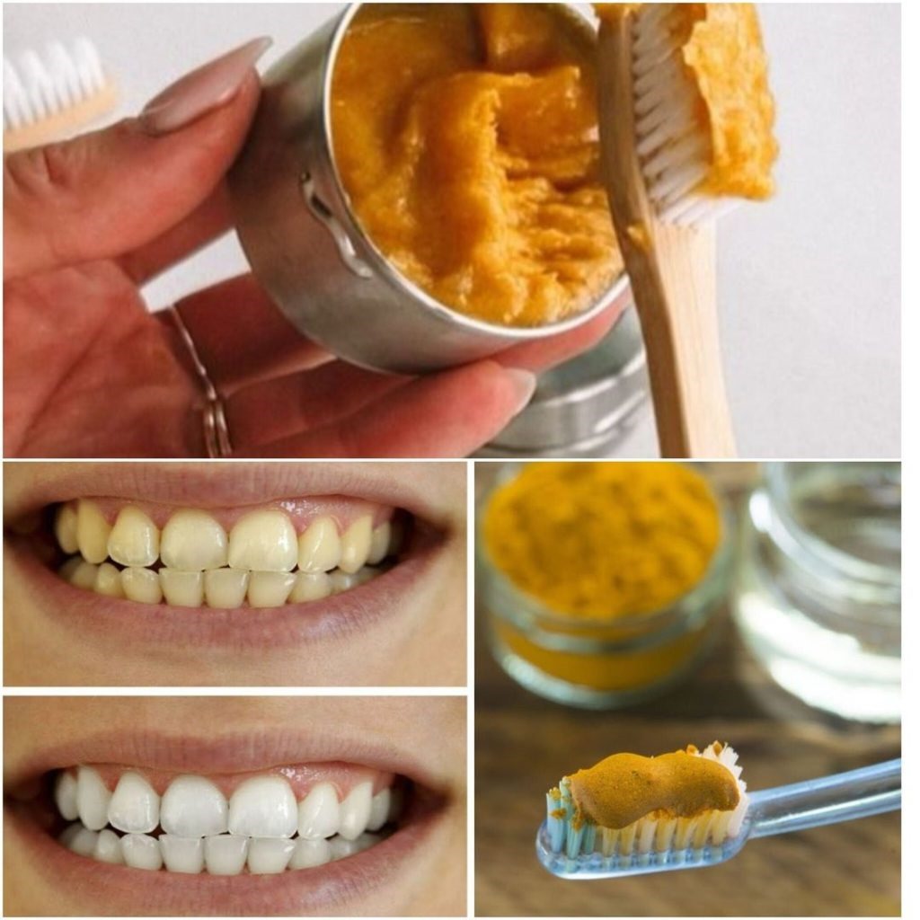 Learn about the natural wonder that turmeric may do for your dental health.Learn about the natural wonder that turmeric may do for your dental health.