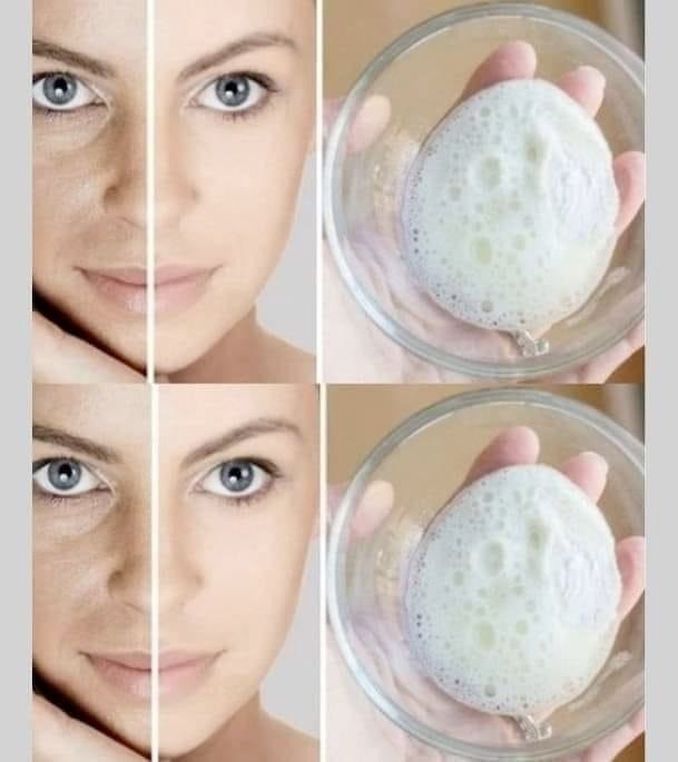 How to Use Baking Soda to Remove Spots, Wrinkles and Dark Circles from the Face