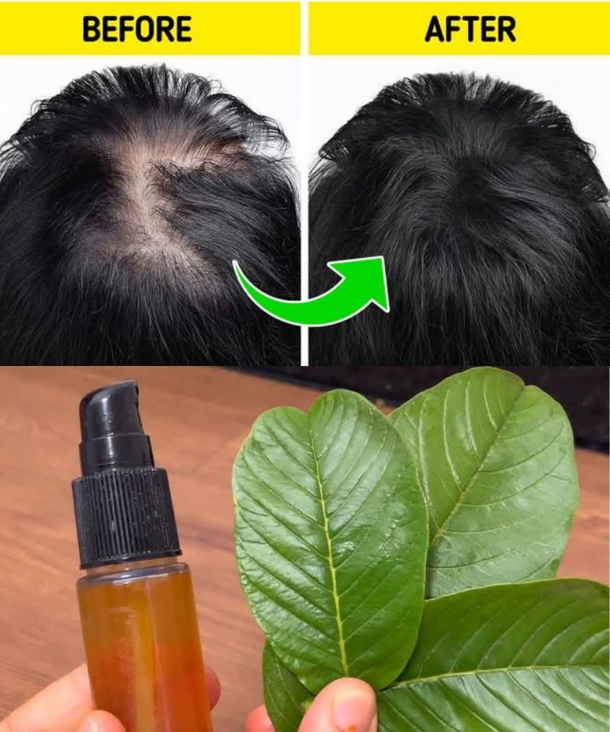 Put Guava Leaves in Your Shampoo and Watch Your Hair Grow Even on Your Forehead!